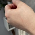 Отзыв о Нарбирилл: Крем от шрамов