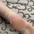 Отзыв о Мазь от Грибка Экзин: Очень хорошая вещь рекомендую